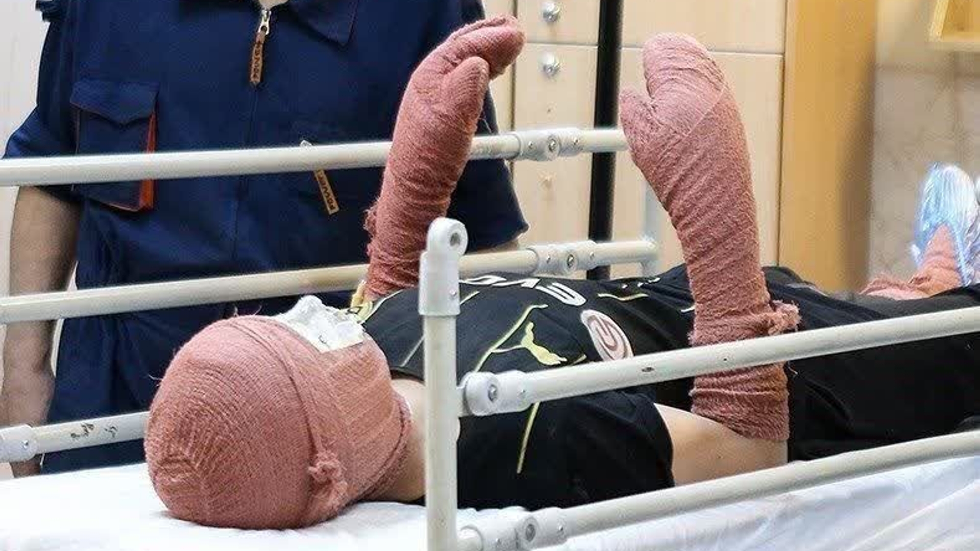 انفجار نارنجک چهارشنبه سوری در دستان نوجوان 13 ساله و قطعی سه انگشت وی